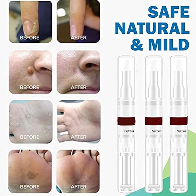 1+1 FREE | SpotWipe™ Gentle Removal