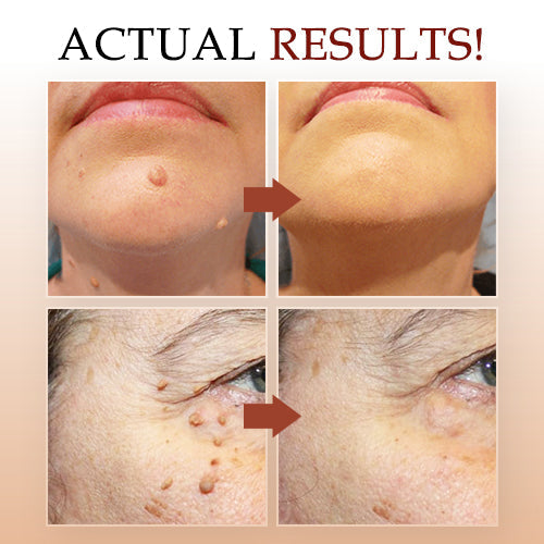 1+1 FREE | SpotWipe™ Gentle Removal