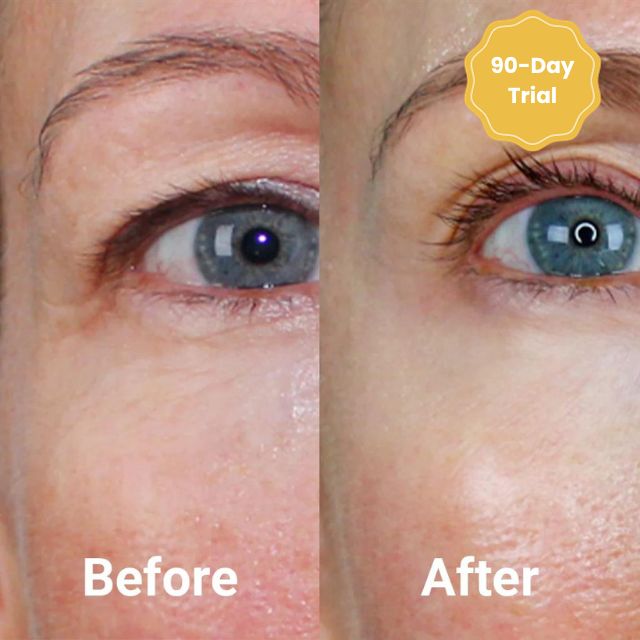 VivaLift™ Collagen Thread Kit — Lift and Renew Your Skin Instantly for a Youthful Glow