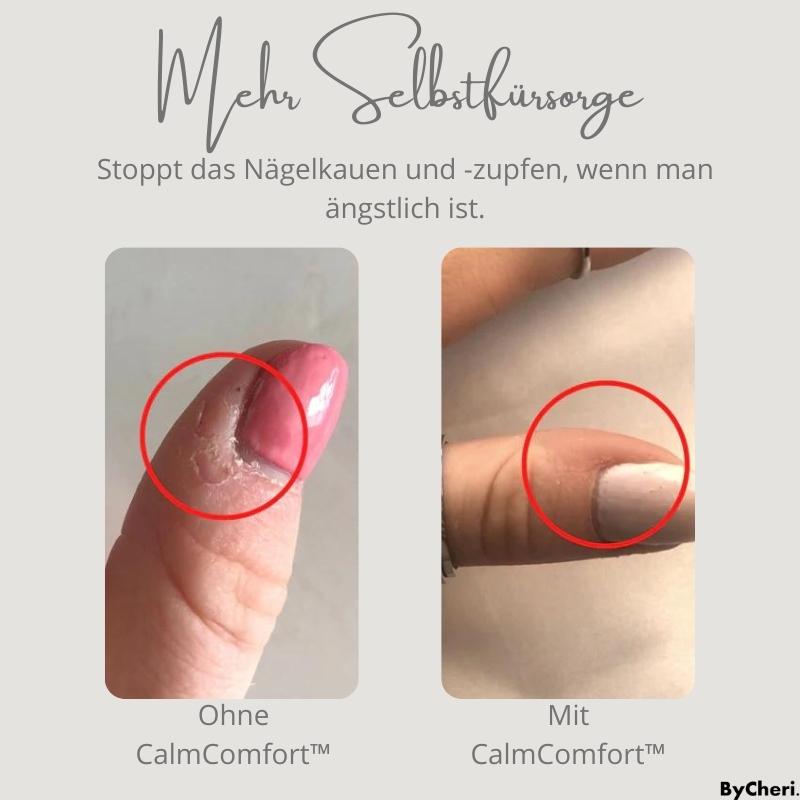1+1 FREE TEMPORARY | CalmComfort™ - Adjustable Bulge Enhancer Tightener
