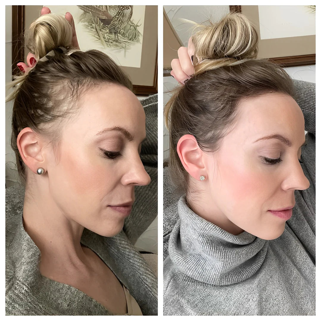 1+1 FREE | RiceGlow™ - Hair Loss Prevention (Final Day Discount)