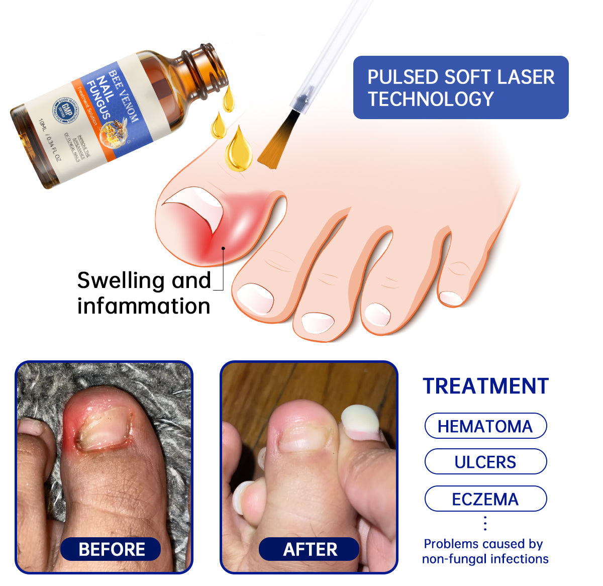 1+1 FREE | Aurelia™ Naturally Strengthen and Nourish Your Nails for Health