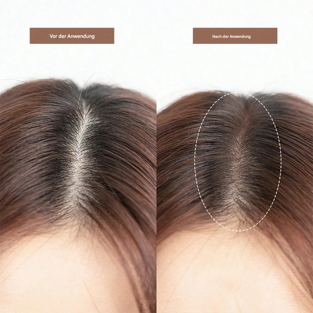 1+1 Free | HairCover™ Eliminate Sparse Hair and Achieve Effortless Perfect Hairline Coverage