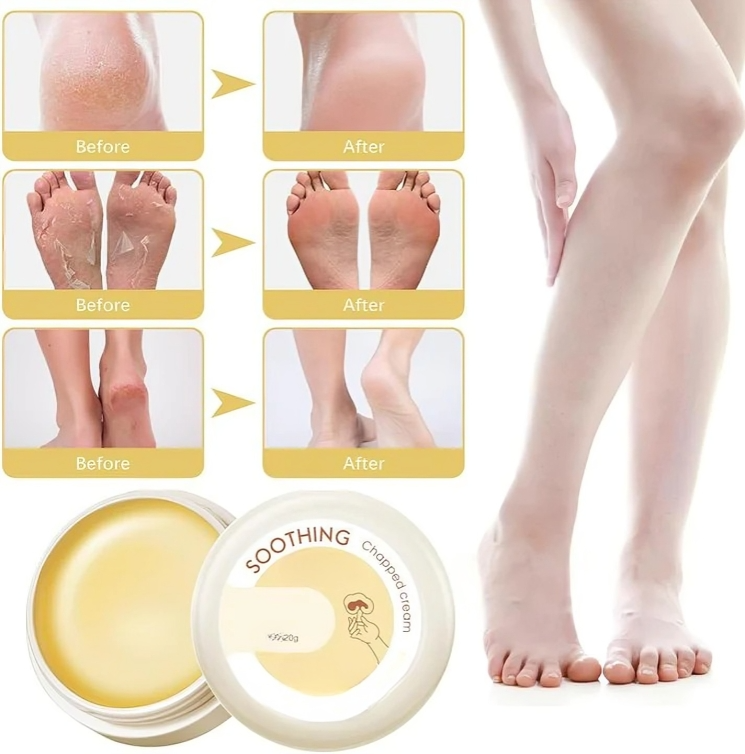 VelvetTouch™ — Heal Dry, Cracked Skin Instantly for Silky, Touchable Smoothness