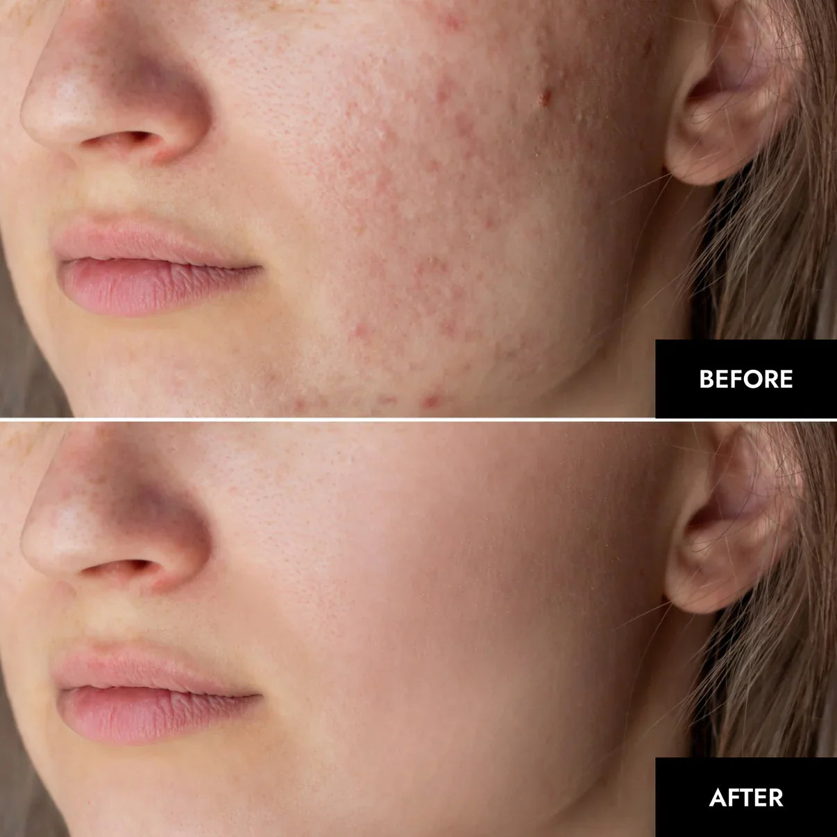 1+1 Free|NatuGlow™ – The Perfect Solution for Immediately Smoother, Radiant Skin