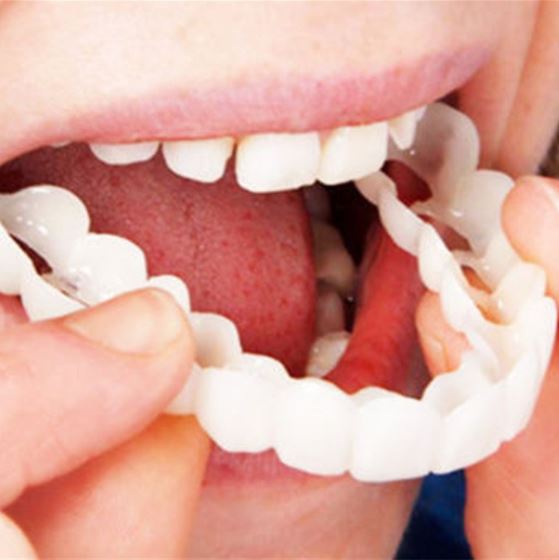 Snap-on Smile™ — Effortless Flawless Confidence | 50% Off