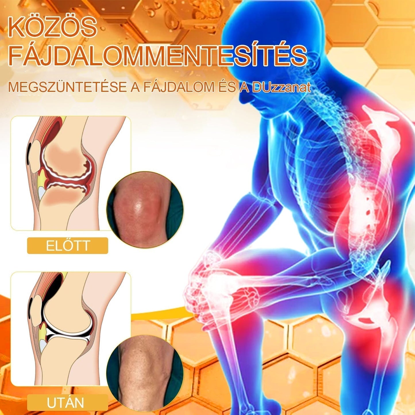 FlexuraBalm™ — Unlock Rapid Relief and Move Freely Again Without Pain or Stiffness