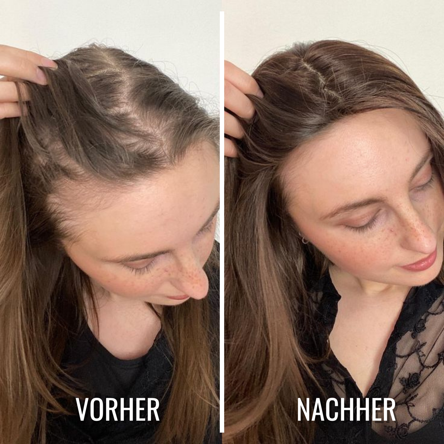 NaturaMane™ Scalp Elixir — Ignite Your Roots for a Thick, Radiant Crown Every Day