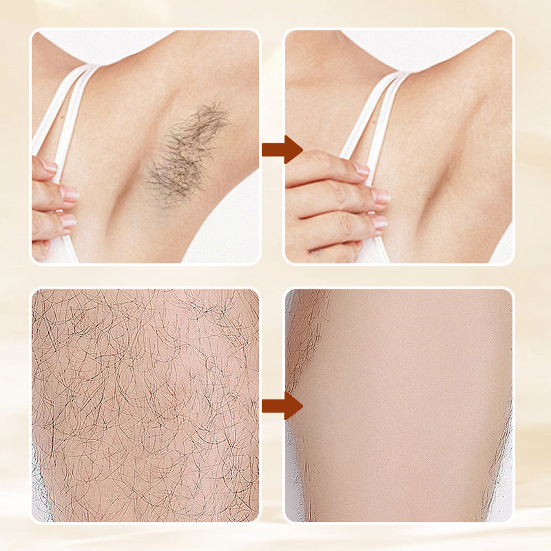 LumeaSilk™ — Unlock Silky, Touchably Smooth Skin Without Pain or Fuss