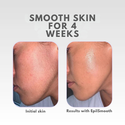RadiantSilk™ — Experience Unstoppable Confidence with Silky, Irritation-Free Skin for Weeks