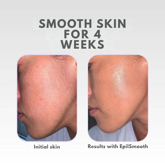 RadiantSilk™ — Experience Unstoppable Confidence with Silky, Irritation-Free Skin for Weeks