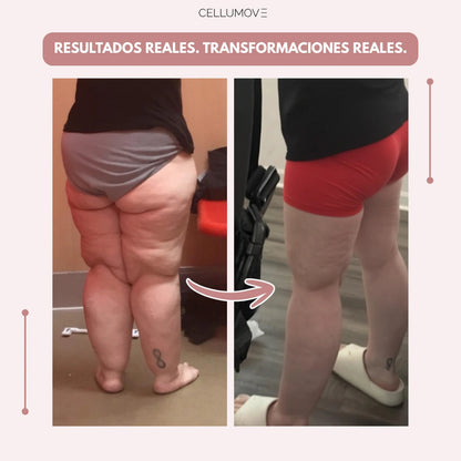 VitaStride™ — Feel Energized Legs and Say Goodbye to Swelling All Day