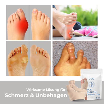 Orthopedic Hallux Valgus Corrector™ — Instant Foot Pain Relief | 1+1 Free