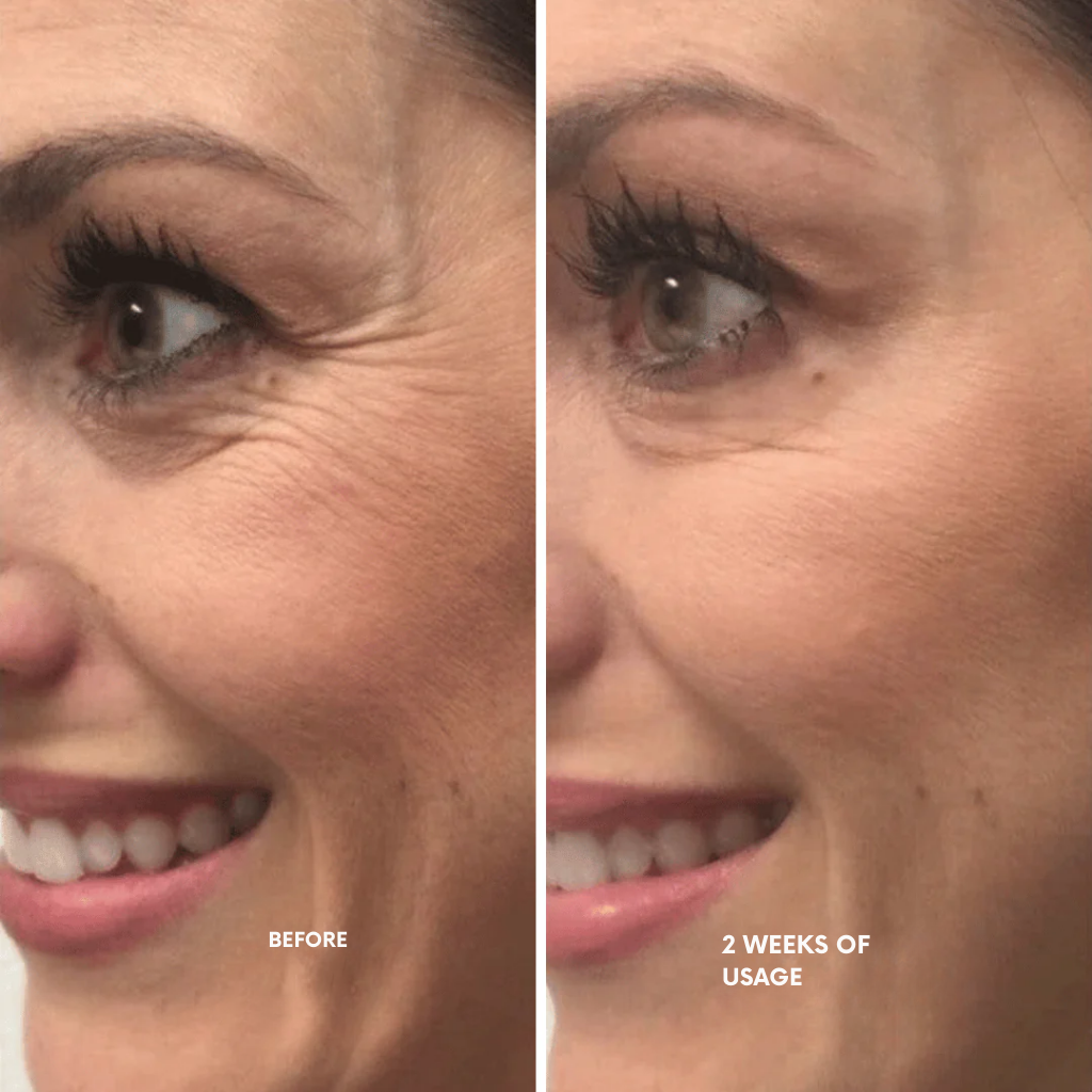 RadiantMuse™ — Reveal Youthful Glow and Smooth, Firm Skin in Just 14 Days