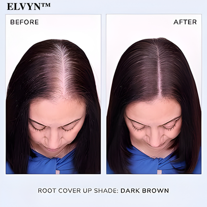 VividStrand™ — Instantly Erase Grays and Reclaim a Fuller, Natural Hairline