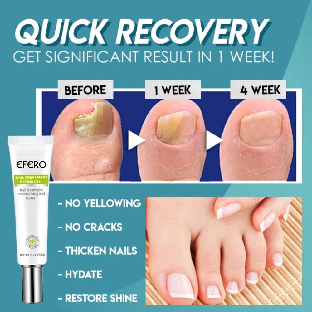 EverNail™ — Reveal Strong, Stunning Nails That Command Attention in Just One Week