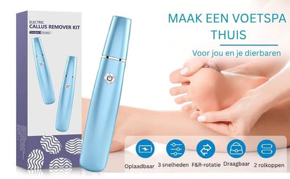 FootRenew™ - Eliminate Painful Calluses with Professional-Grade Strength and Comfort