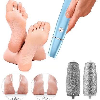 FootRenew™ - Eliminate Painful Calluses with Professional-Grade Strength and Comfort