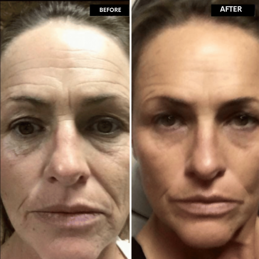 RadiantMuse™ — Reveal Youthful Glow and Smooth, Firm Skin in Just 14 Days