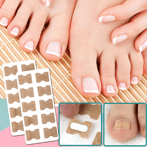 (50% Discount) FinePatches™ | Nail Correction Patches for Healthy and Beautiful Nails