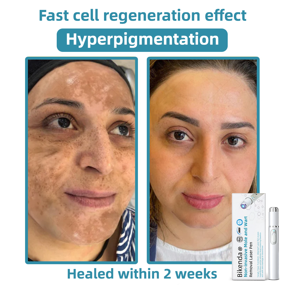 LuminaraTouch™ — Effortless Laser Precision for Radiant, Flawless Skin Fast