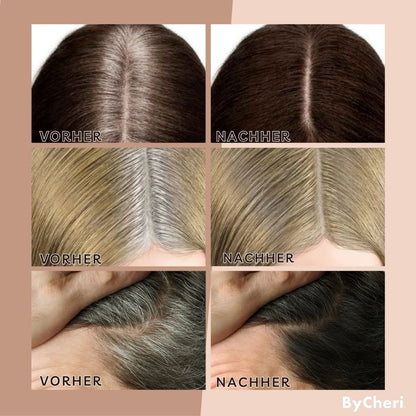 EasyBlend™ — Instantly Fuller, Natural Hairlines | 1+1 Free