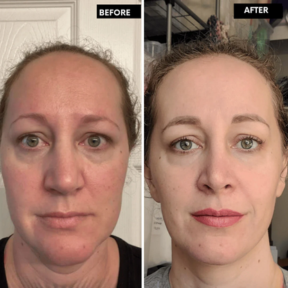 RadiantMuse™ — Reveal Youthful Glow and Smooth, Firm Skin in Just 14 Days