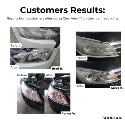 ClearGlow | Headlight Repair Fluid I Last Day 1+1 FREE🔥