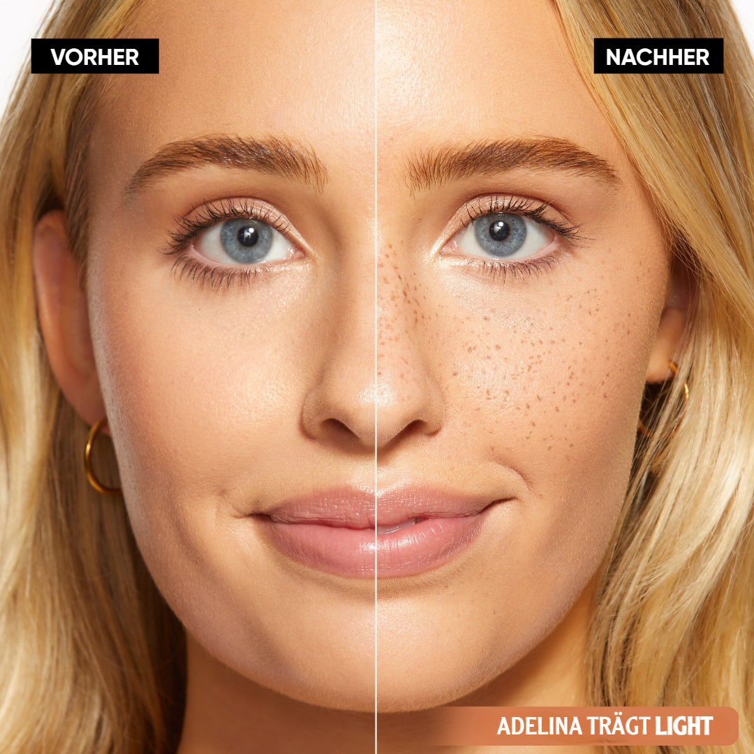 FrecklEase™ — Unlock Your Effortless, Sun-Kissed Confidence Instantly