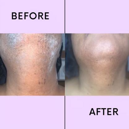 SilkMelt™ — Effortless, Pain-Free Smoothness That Boosts Your Confidence Instantly