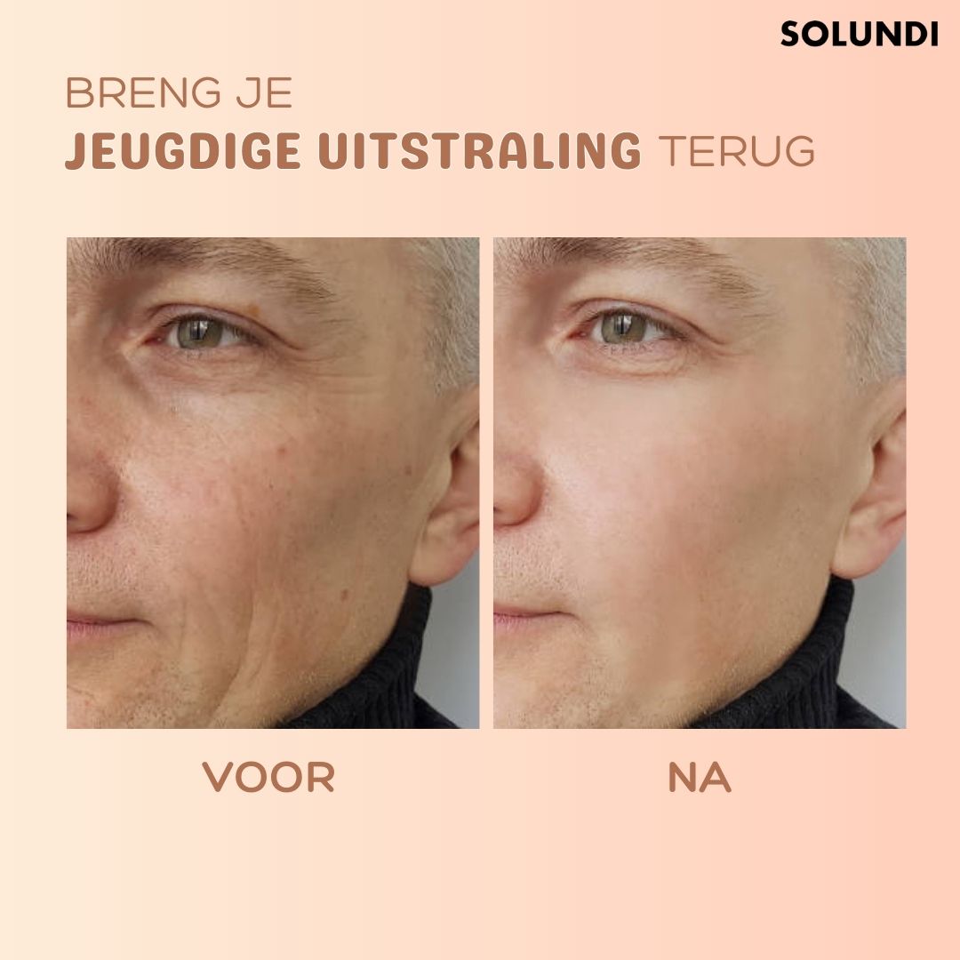 (1+1 FREE) SmoothBalm™ Skin Renewal Balm with Anti-Wrinkle Formula