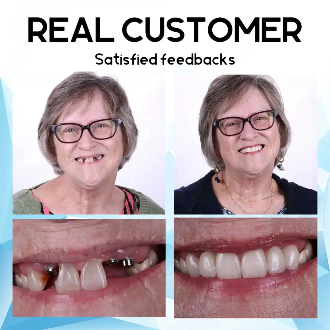 RamiraSmile™ — Unlock Unshakable Confidence with Effortless, All-Day Comfort