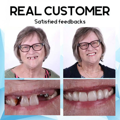 RamiraSmile™ — Unlock Unshakable Confidence with Effortless, All-Day Comfort
