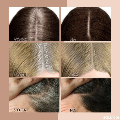 EasyBlend - Bye-Bye Hairline | 1+1 FREE ONLY TEMPORARILY