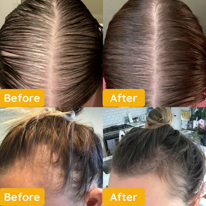 Hair Growth Oil - Essential Oil for Hair Growth with [1+2 FREE] Offer
