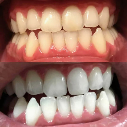 LumaShine™ — Unleash a Brilliant Smile That Commands Every Room