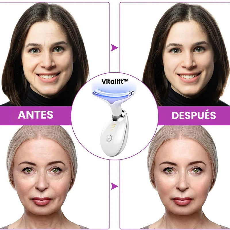 GlowLift | Facial Contouring Massager