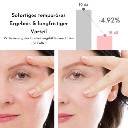 VioraLuxe™ Eye Renewal Stick — Reveal Youthful, Radiant Eyes That Captivate Instantly