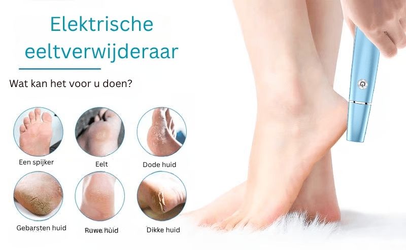 FootRenew™ - Eliminate Painful Calluses with Professional-Grade Strength and Comfort