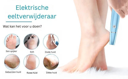 FootRenew™ - Eliminate Painful Calluses with Professional-Grade Strength and Comfort