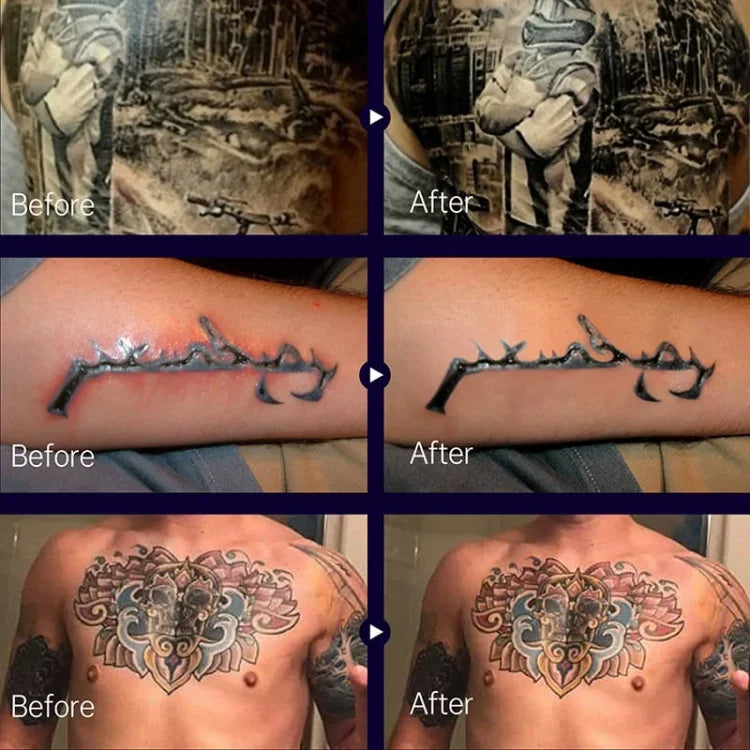 InkRenew™ | Maintain Your Tattoo Fresh and Flawless