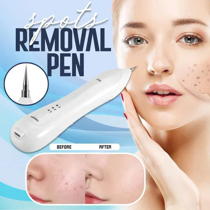 SpotClear | Zap Dark Spots Pain-Free & Fast | 50% Off