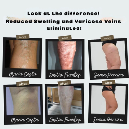 RevitaStep™ — Wake Up Tired Legs with Soothing Heat and All-Day Comfort