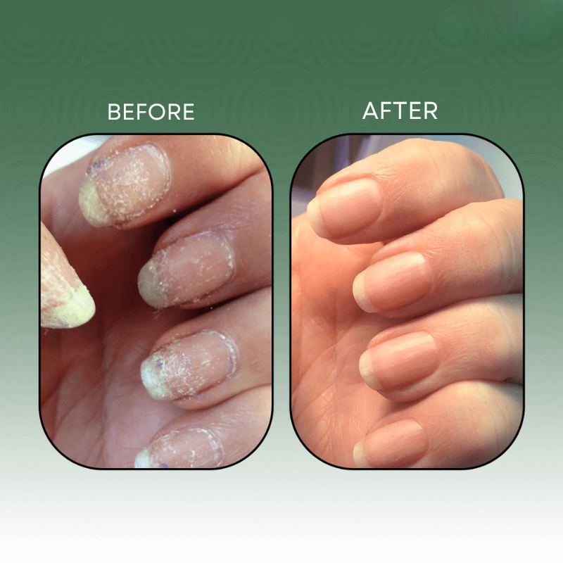 NailForge™ — Turn Weak, Dull Nails Into Your Boldest Confidence Statement