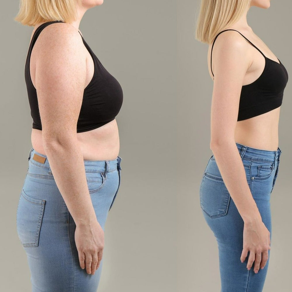 SculptEase™ — Melt Fat and Reveal Smooth, Confident Curves Fast