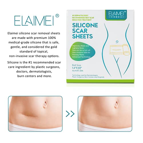 Medical Soft Silicone Gel Tape Designed for Scar Removal