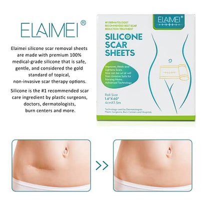 Medical Soft Silicone Gel Tape Designed for Scar Removal