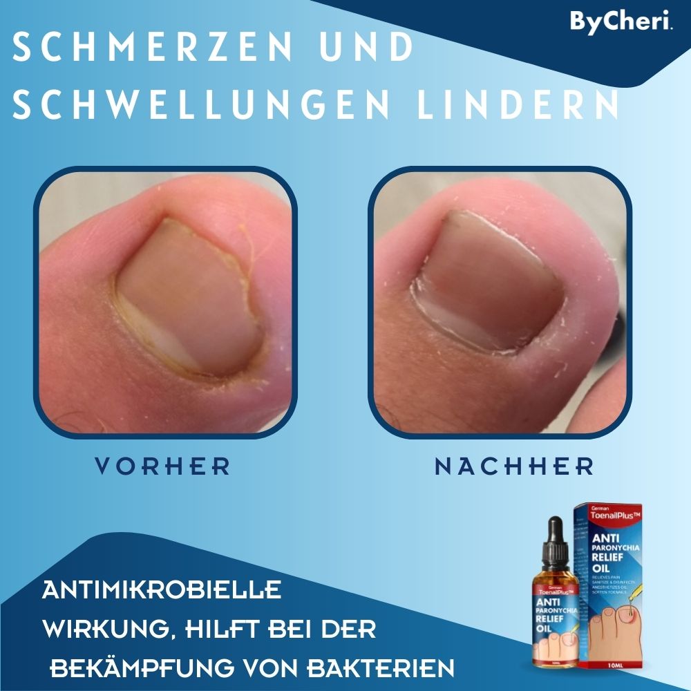 ToePerfect | Heal Nails Fast, Live Pain-Free | 50% Off
