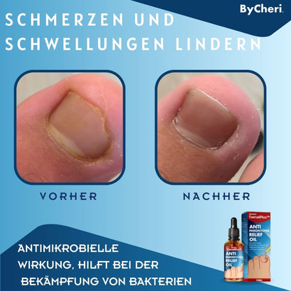 ToePerfect | Heal Nails Fast, Live Pain-Free | 50% Off