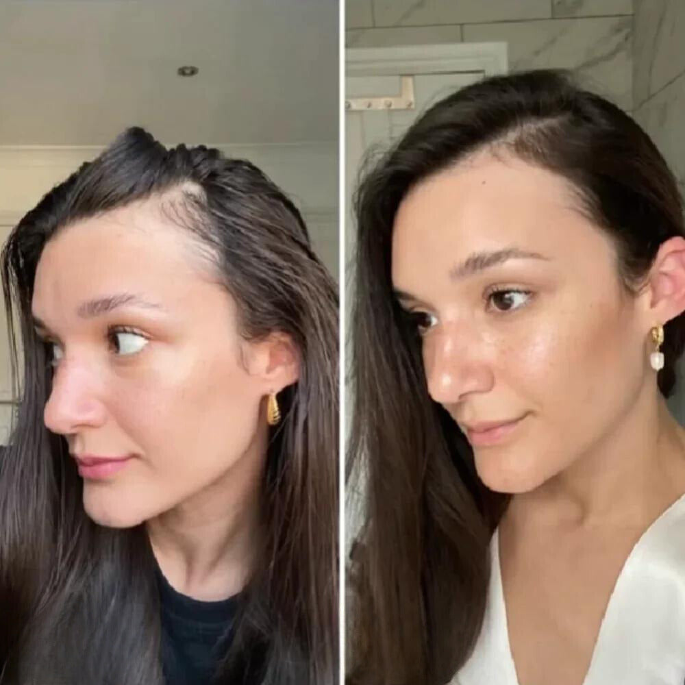 VitraThick™ — Unlock Lush, Head-Turning Hair That Powers Your Confidence